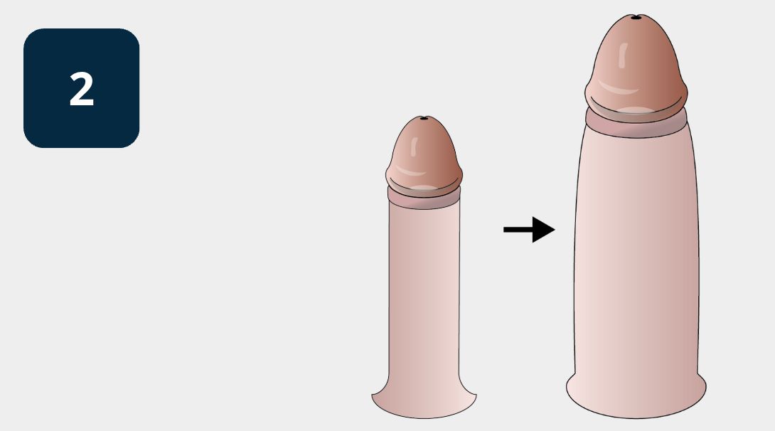 Aumento Imediato com Urolarge